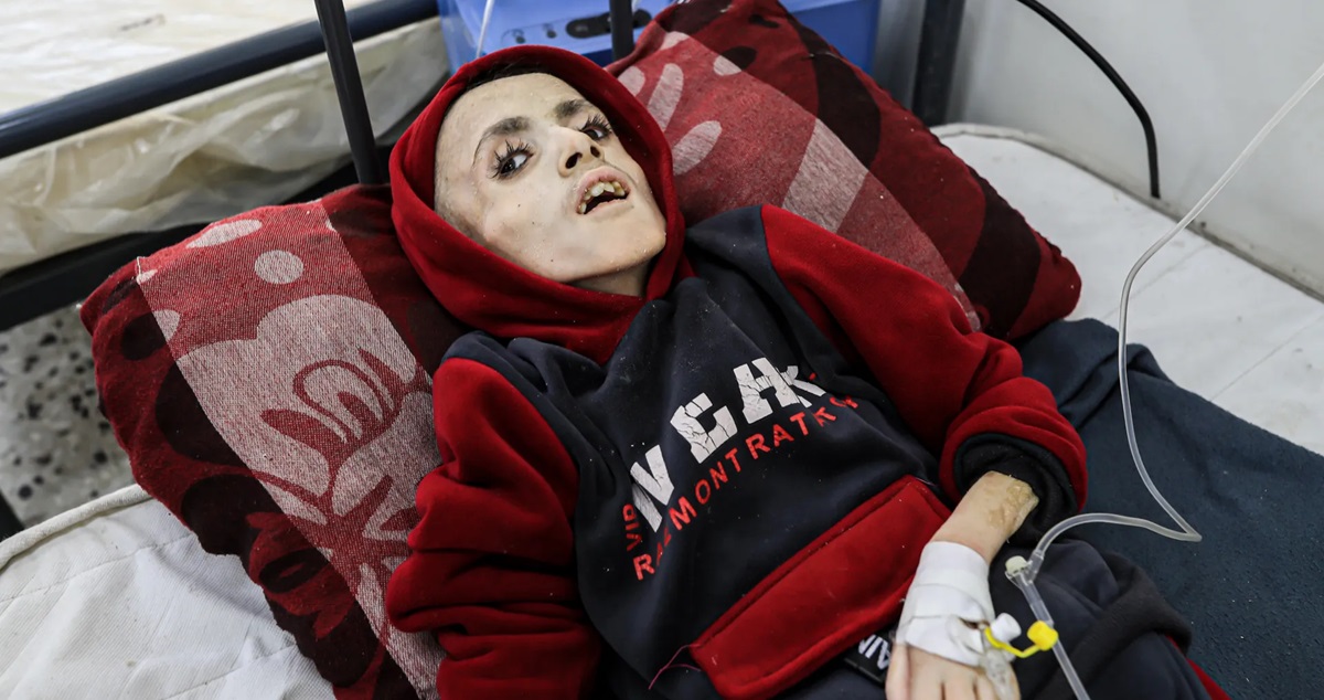 طفل في غزة يرتقي بسبب الجوع